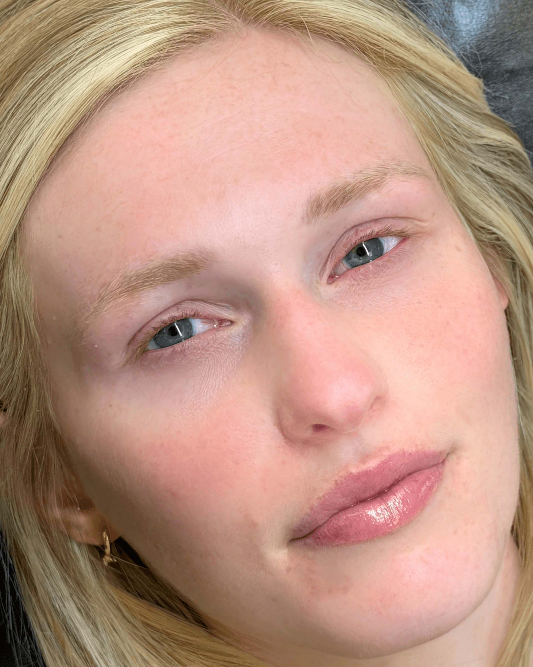 Duo Brows. Before treatment