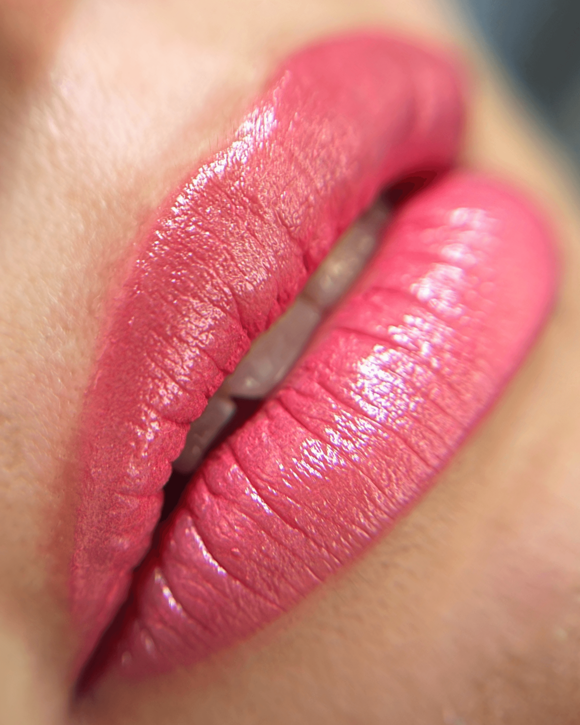 Nano Lips. After treatment